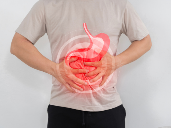 Gastric Balloon